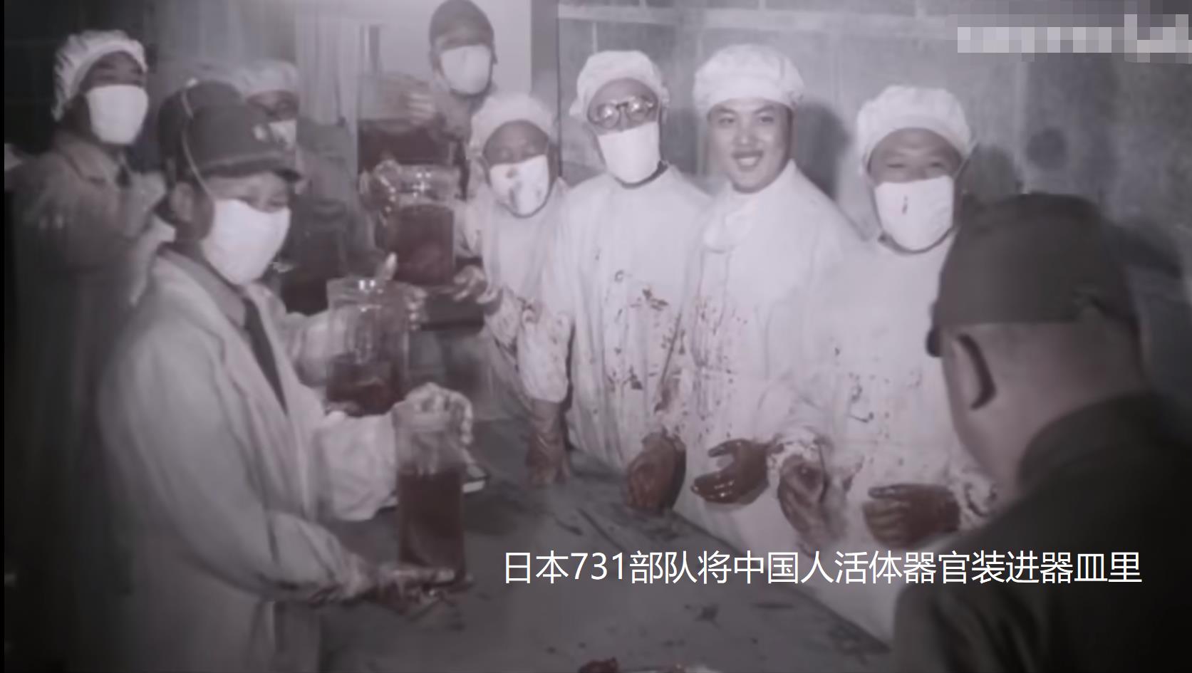 日本731部队的残忍的人活体解剖实验类型有哪些？