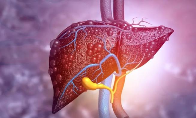 人源化肝脏小鼠模型是如何发现慢性肝脏疾病？