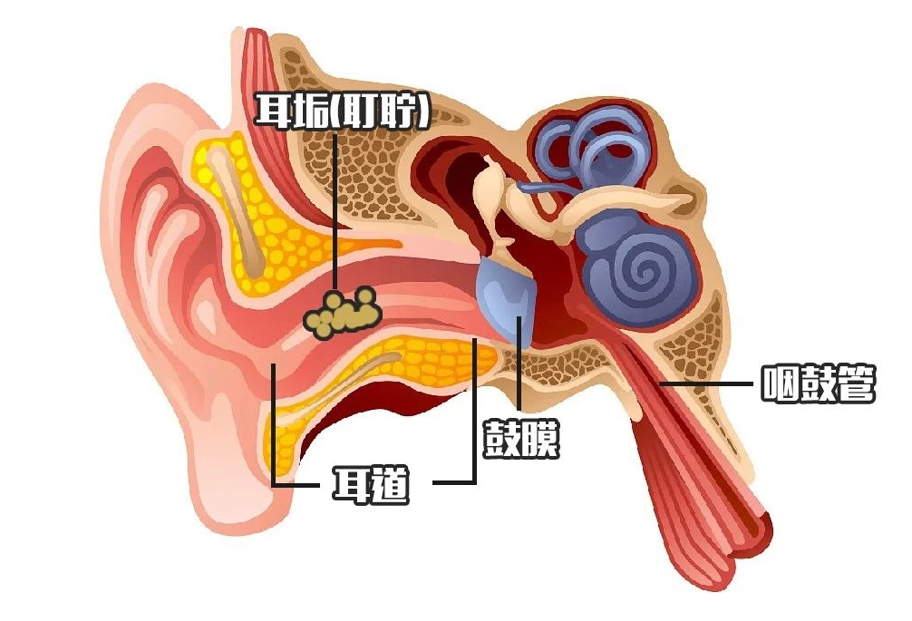 耳屎，到底能不能掏？